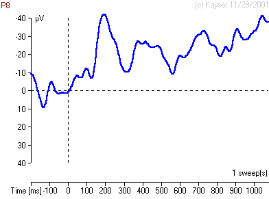 EEG/ERP sweeps of right parietal surface potentials (gif file 240 kB)