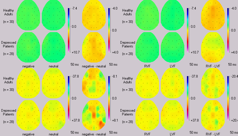 Surface Potentials and Spherical Spline Topographies (avi file 5.8 MB)