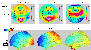sLORETA CSD-PCA Overall Amplitude (flash animation 3.0 MB)