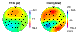 Animation of EEG and CSD topographies during a single EEG epoch (flash 2.5 MB)