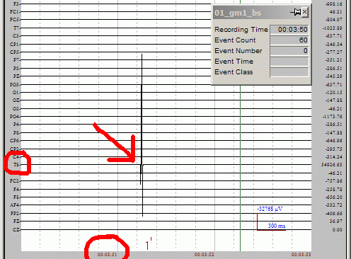 Brief Recording Artifact: EDIT Display